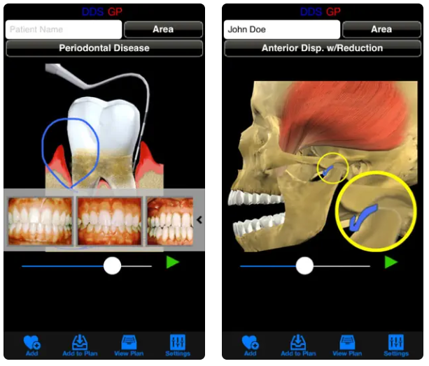 DDS GP iPhone App for Dentists Review
